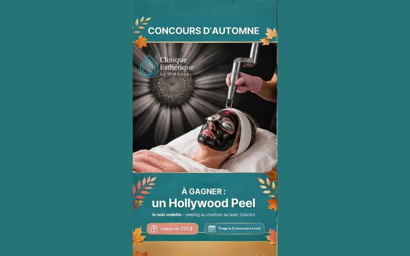 Gagnez un peeling au charbon au laser Spectra